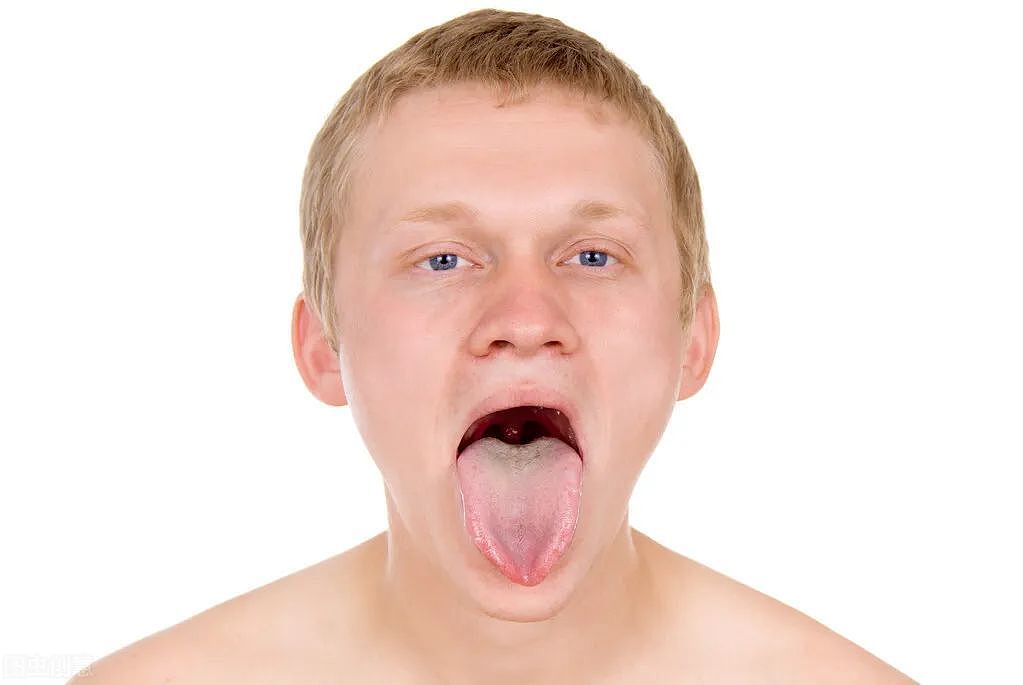 中医舌诊能看出什么？舌苔胖大有齿痕，或是这6种疾病的信号 - 1