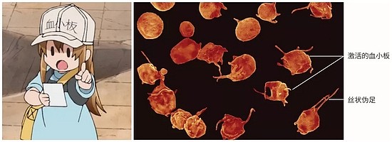 左：《工作细胞》中拟人化的血小板 右：实际的血小板与血小板的激活|John Weisel， PhD， Perelman School of Medicine， University of Pennsylvania