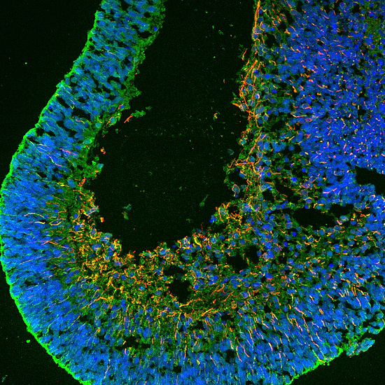 科学家用一种新造的细胞，“唤醒”人类视网膜的再生能力 - 3