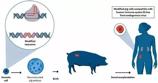 猪肾成功植入人体，但器官移植新时代还远未到来 - 2