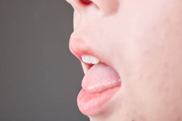舌下有青筋，是怎么回事？青筋出现2种异常时，要注意 - 3