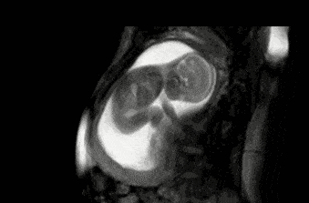 孕期胎儿在黑漆漆的子宫里会无聊吗？不！胎儿的“日常”很有趣 - 7