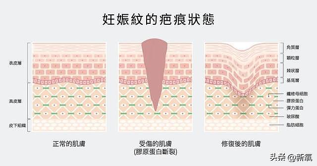 她别真是未婚先孕吧，顶着自毁前程的风险也要和渣男闪电完婚 - 35