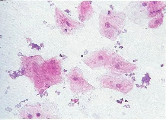 显微镜下的口腔上皮细胞，医学上也通过口腔拭子刮取这类细胞进行DNA鉴定 （图源：flickr）