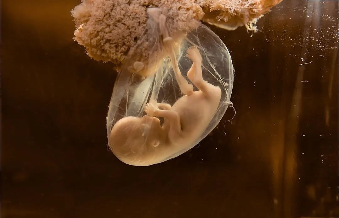 怀孕期间，为什么胎儿突然没有了胎心？这些原因，孕妈别忽视 - 3