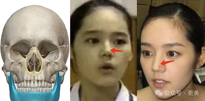 韩素希割双眼皮前，就是典型的韩式肿眼泡啊… - 33