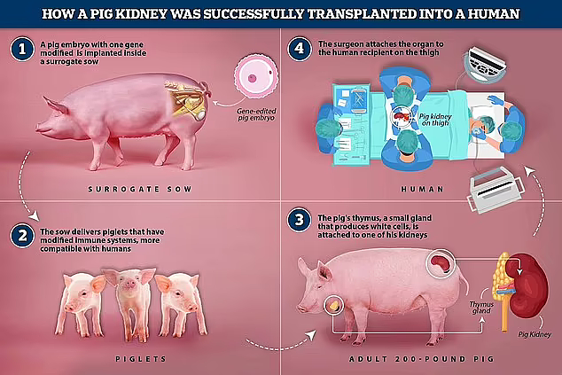 美科学家“猪肾”移植手术成功，47岁大叔受益，患者：很实用！ - 3