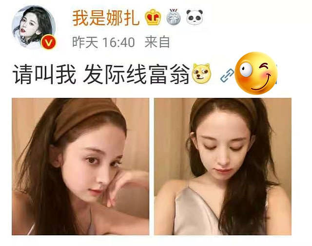 发际线危机的明星：唐嫣杨幂脑门光秃，王一博鞠婧祎离不开阴影粉 - 15