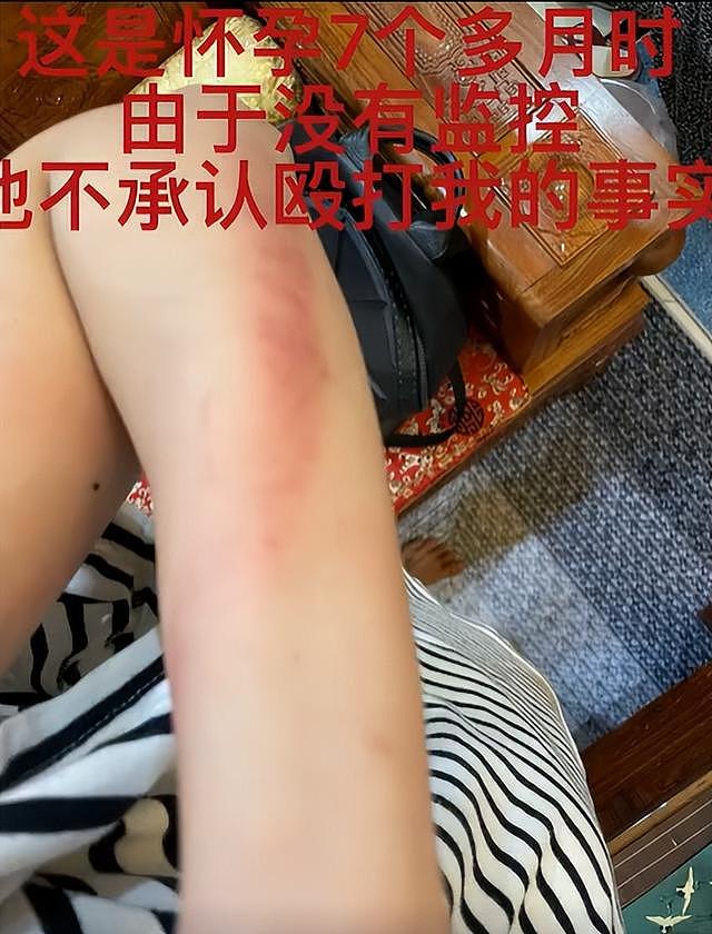 演员王东家暴视频曝光，掐妻子脖子用木板殴打，本人发文道歉 - 11
