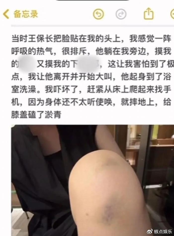 网红李嘉欣遭侵犯！发长文控诉倪海杉好兄弟王保长，晒伤痕太惊心 - 8