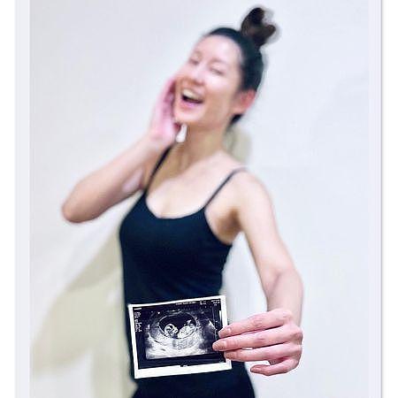 2022年第1发喜讯，36岁许孟哲迎二胎，名模妻子怀孕3月身材仍纤细 - 6