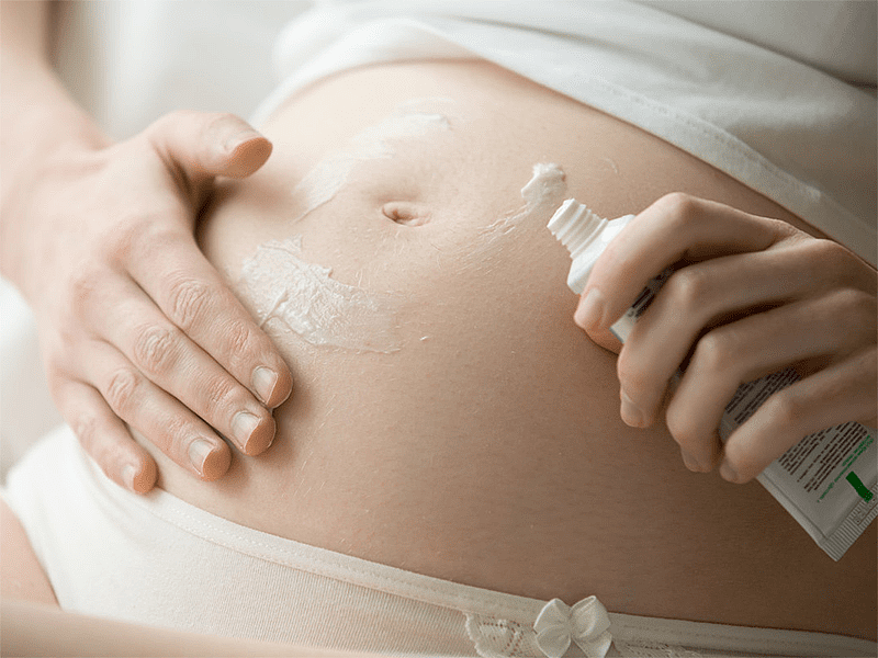 怀孕期间如何避免出现妊娠纹？ - 2