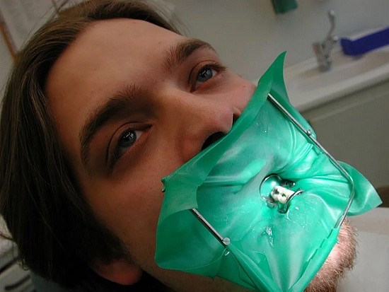 橡皮障是牙医用来隔挡口腔唾液的橡皮布 | 图源：Wikimedia Commons