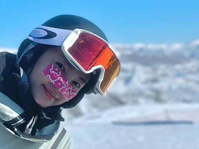 张雨绮滑雪照片火了，在鼻子上贴“创可贴”，引起网友热议 - 5