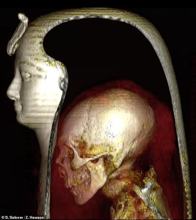 CT扫描首次“数字化拆封”古埃及法老木乃伊，生前曾受割礼 - 5