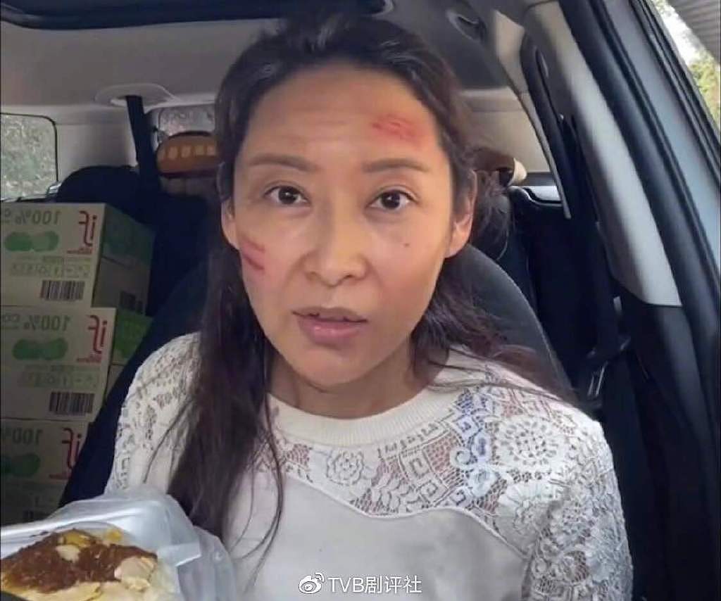 疑被家暴？TVB女星带伤拍外景脸色憔悴，与男友拍拖十多年仍未结婚 - 4