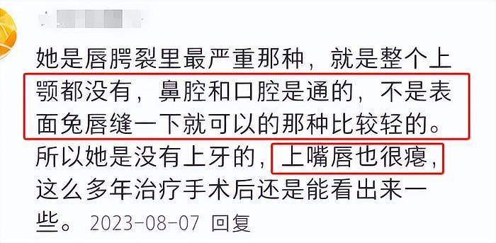 李嫣18岁近照神似李湘！造型妆容被指太过成熟，鼻子也疑似变了 - 11