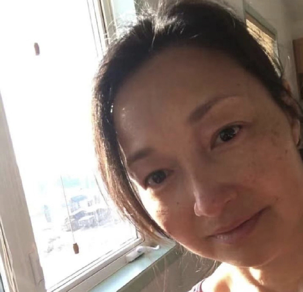 52岁港姐李绮虹素颜近照曝光，皱纹明显满脸红疹，笑称更年期问题 - 8
