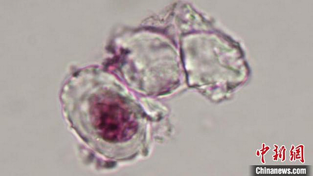 尾羽龙腿骨软骨细胞的显微照片。其中一个细胞中还有经过染色而显示出的细胞核，以及暗色的细丝状染色质。　Alida Bailleul 供图