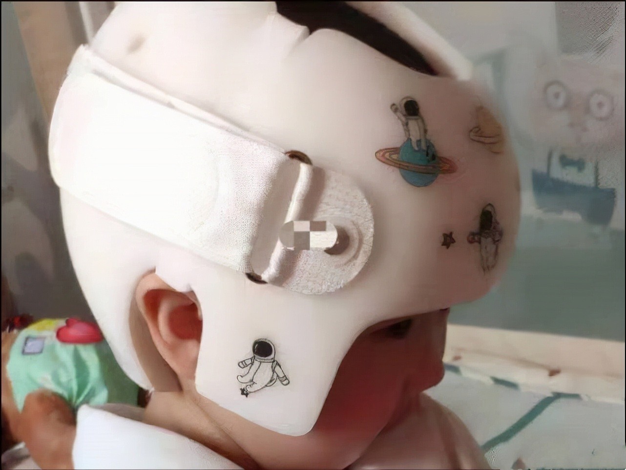 婴儿头盔被官媒点名：古有裹小脚，今有裹小脑，影响发育太坑娃 - 1