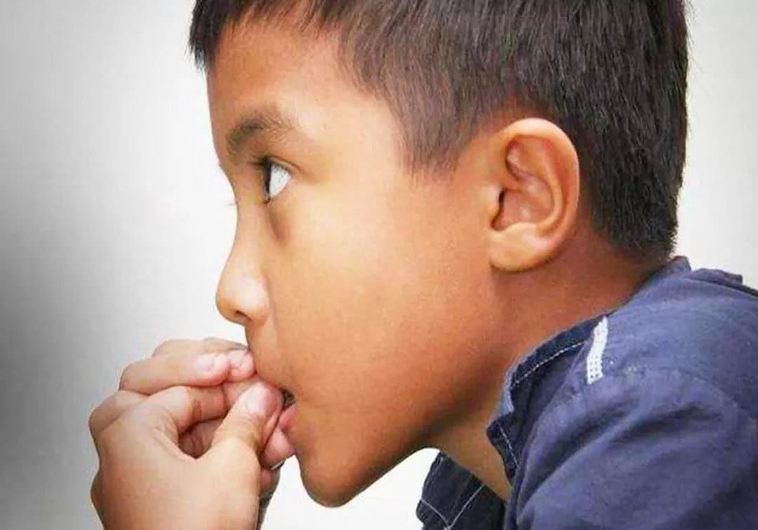 心理学研究发现：经常咬指甲的孩子将来大多是这种性格，令人惋惜 - 2