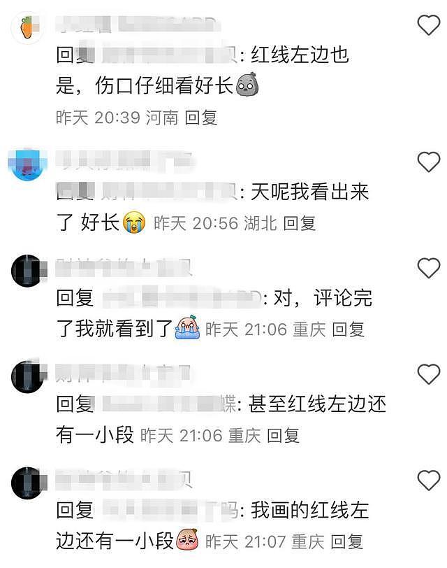 陈奕迅受伤一个月首露面，下巴缝了30针的疤痕好长，恢复情况曝光 - 10