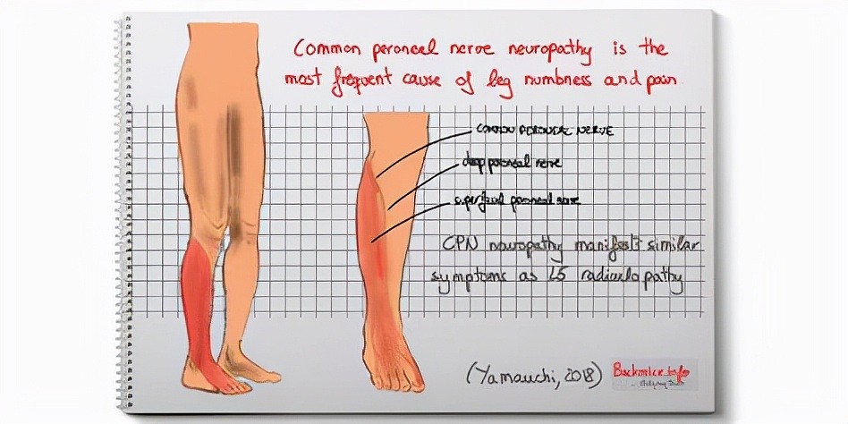 走路腿疼，还抽筋，需要补钙吗？医生提醒：可能是血管问题 - 1