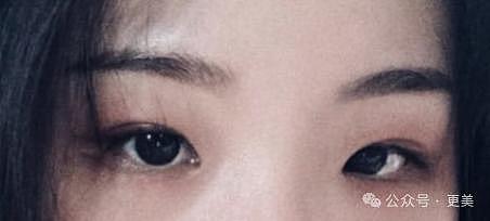 韩素希割双眼皮前，就是典型的韩式肿眼泡啊… - 20