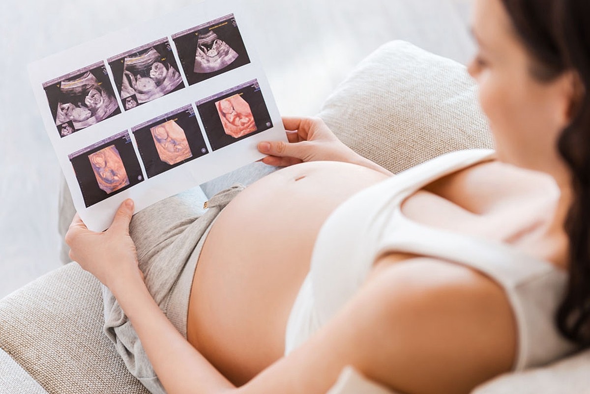四维彩超单上的数据会告诉你胎儿是否健康，孕妈学会看不用求医生 - 2