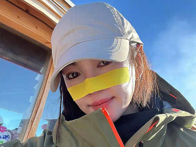 张雨绮滑雪照片火了，在鼻子上贴“创可贴”，引起网友热议 - 3