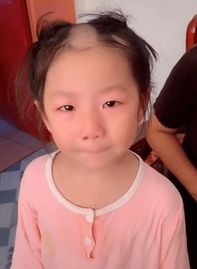 5岁女儿偷玩理发器，剃头后秒变“谢广坤”，网友：忍不住笑出声 - 1