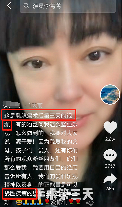 51岁老戏骨李菁菁自曝患癌，90后老公不离不弃婚姻好感人 - 2