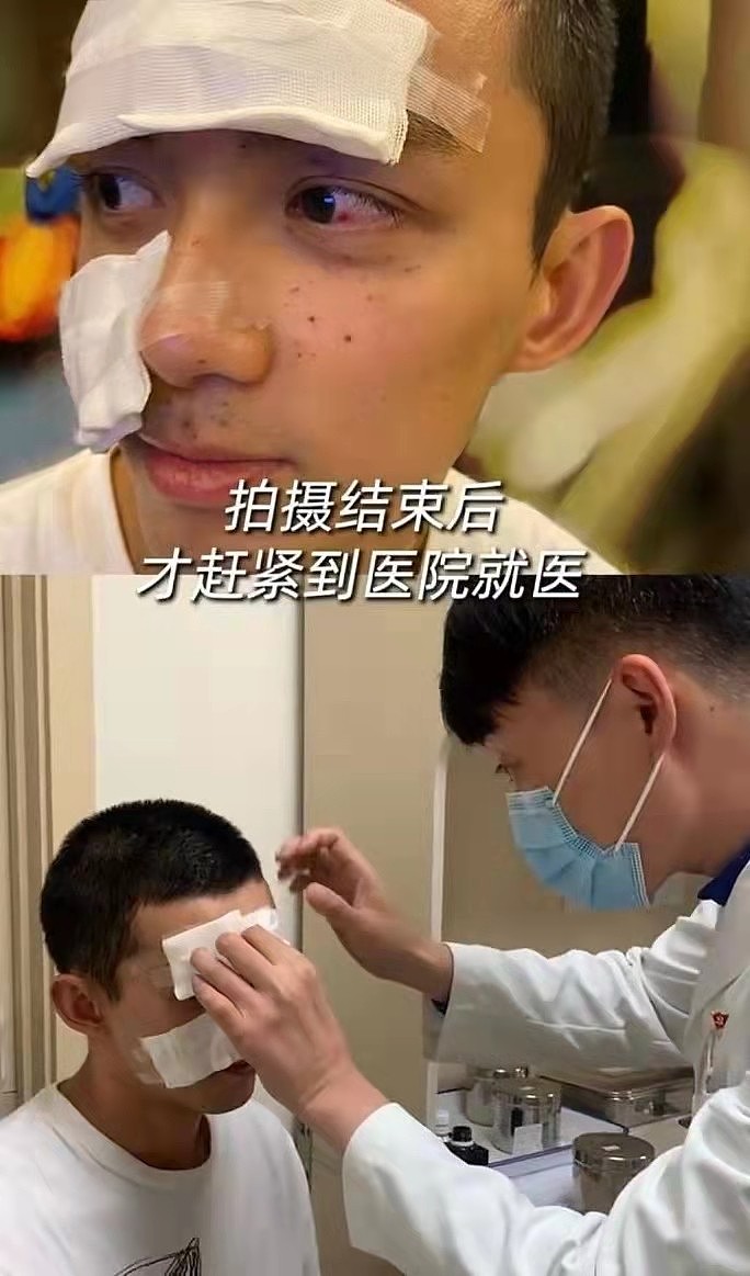 吴磊回应拍电影受伤，从脸上挑出20块火药渣子，导演吴京都心疼他 - 2