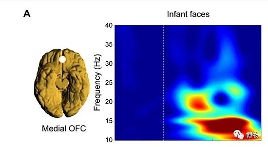 看到动物幼崽时的大脑活动区域 　　图片来源：Morten L。 Kringelbach等
