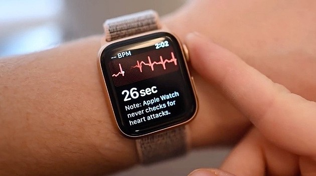 苹果Apple Watch心电图检测救了一名印度牙医，CEO库克回应 - 1