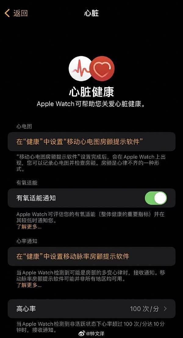 国行Apple Watch终于获得“完全体”！ECG心电图已上线测试版系统 - 3