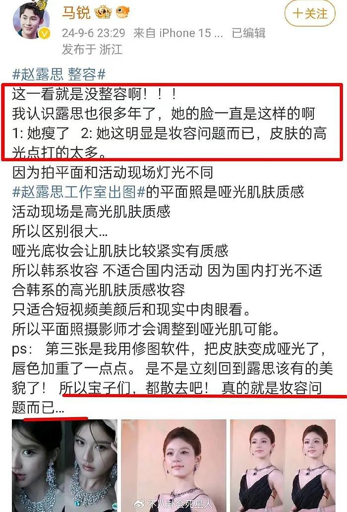 赵露思整容风波闹大了，张大大刘梓晨发声，贾玲无辜被牵连 - 17