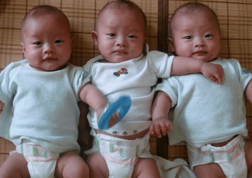 26岁孕妈生下“异卵三胞胎”，小女儿体重最争气，医生：第一次见 - 2
