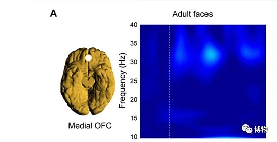 看到成年动物时的大脑活动区域 　　图片来源：Morten L。 Kringelbach等