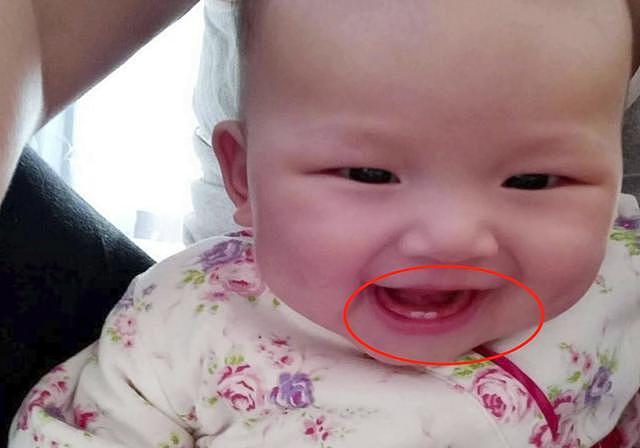宝宝究竟多大长牙才算正常？宝妈对照“出牙顺序表”就心理有数了 - 4
