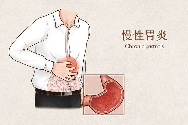 慢性胃炎医疗插画（企业商用）.jpg