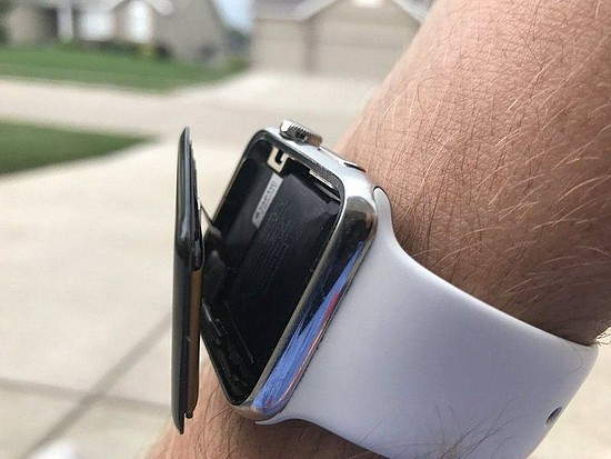 苹果面临集体诉讼：Apple Watch手表电池膨胀弹出显示屏 - 1