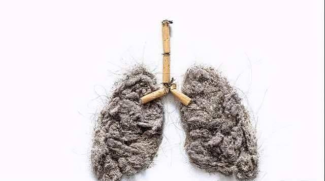 长期抽烟的人，身体有2个“凸点”， 出现一种，最好查下肺CT - 3