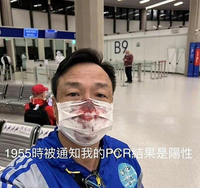 男星抵台湾接受PCR检测，被医护捅伤鼻孔流血，自爆结果为阳性 - 3