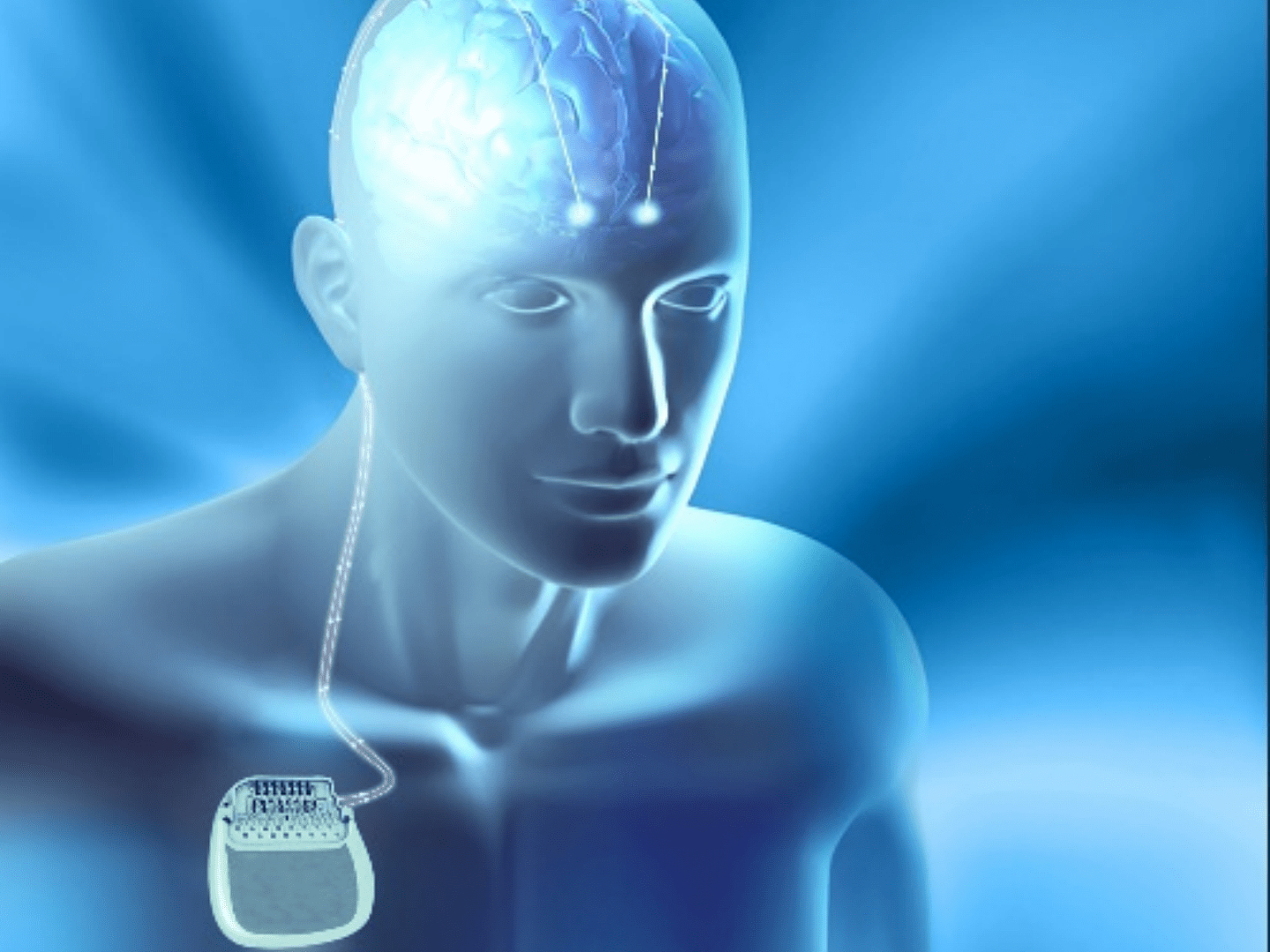 2021进博会｜全球首款具备感知技术的脑起搏器亮相进博会，预计明年在中国上市 - 2