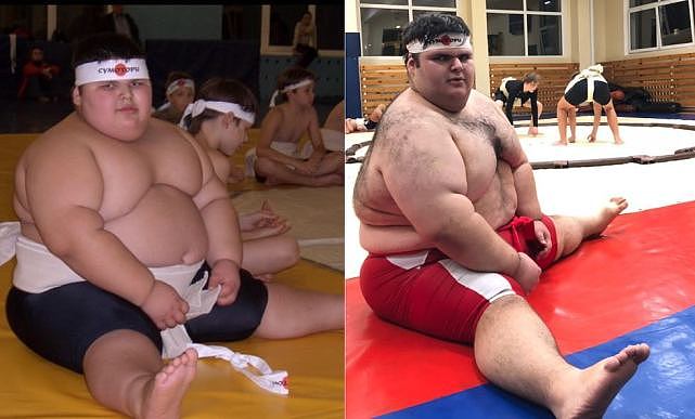 俄“世界最胖孩子”离世，仅21岁，出生体重标准9岁时近三百斤