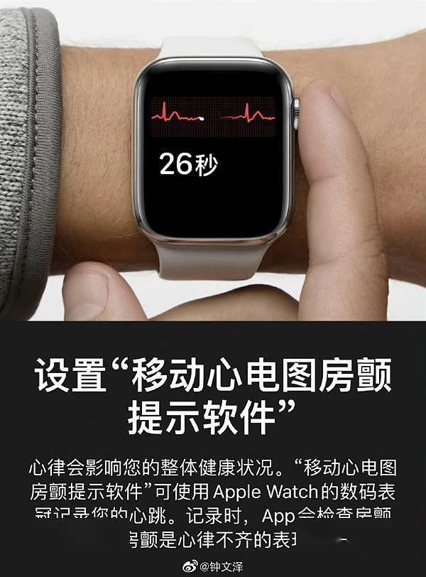 国行Apple Watch终于获得“完全体”！ECG心电图已上线测试版系统 - 1