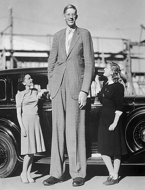 世界上最大的人  身高直逼三米 - 1