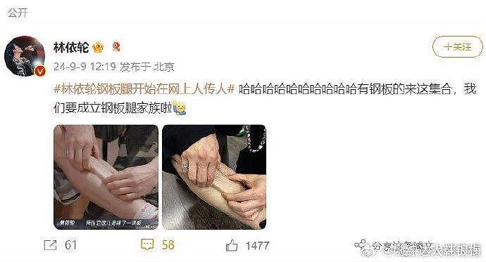 钢板腿真的让人惊讶呀，一整个真的学到了 - 1