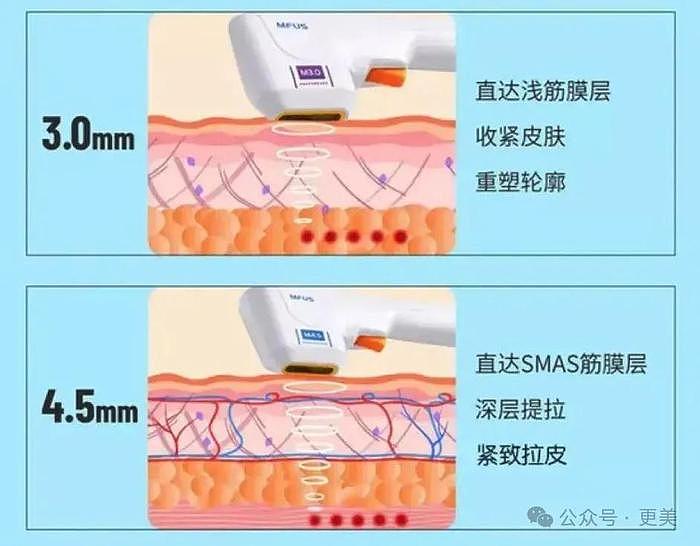 爷孙恋66岁男主去世后，27岁女友偷外卖充饥… - 75